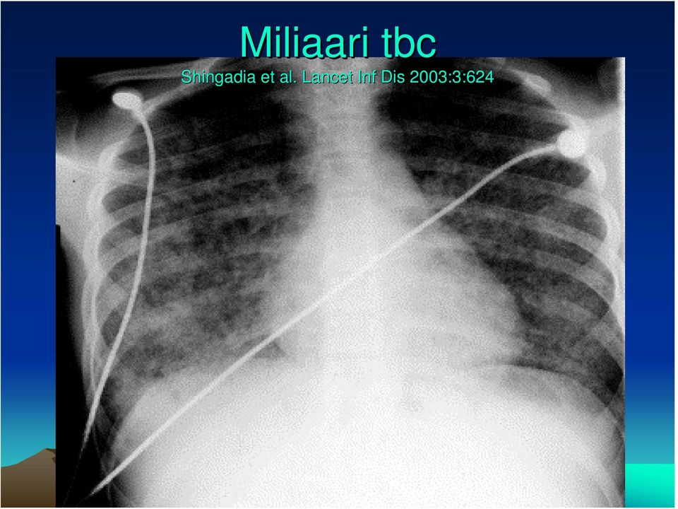 al. Lancet