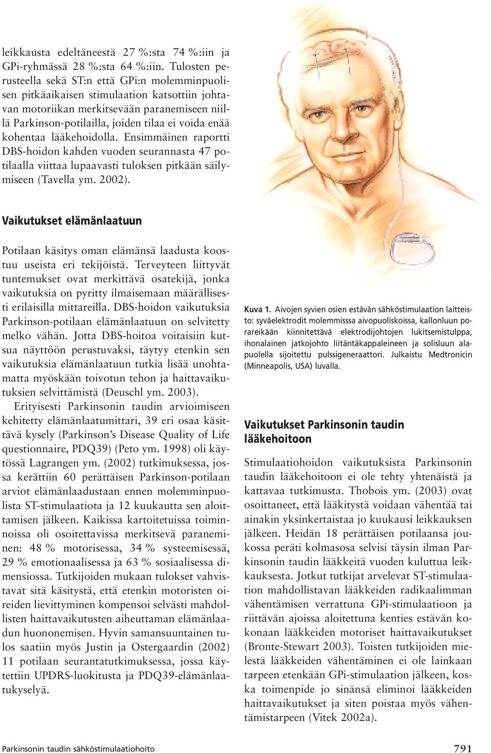 kohentaa lääkehoidolla. Ensimmäinen raportti DBS-hoidon kahden vuoden seurannasta 47 potilaalla viittaa lupaavasti tuloksen pitkään säilymiseen (Tavella ym. 2002).