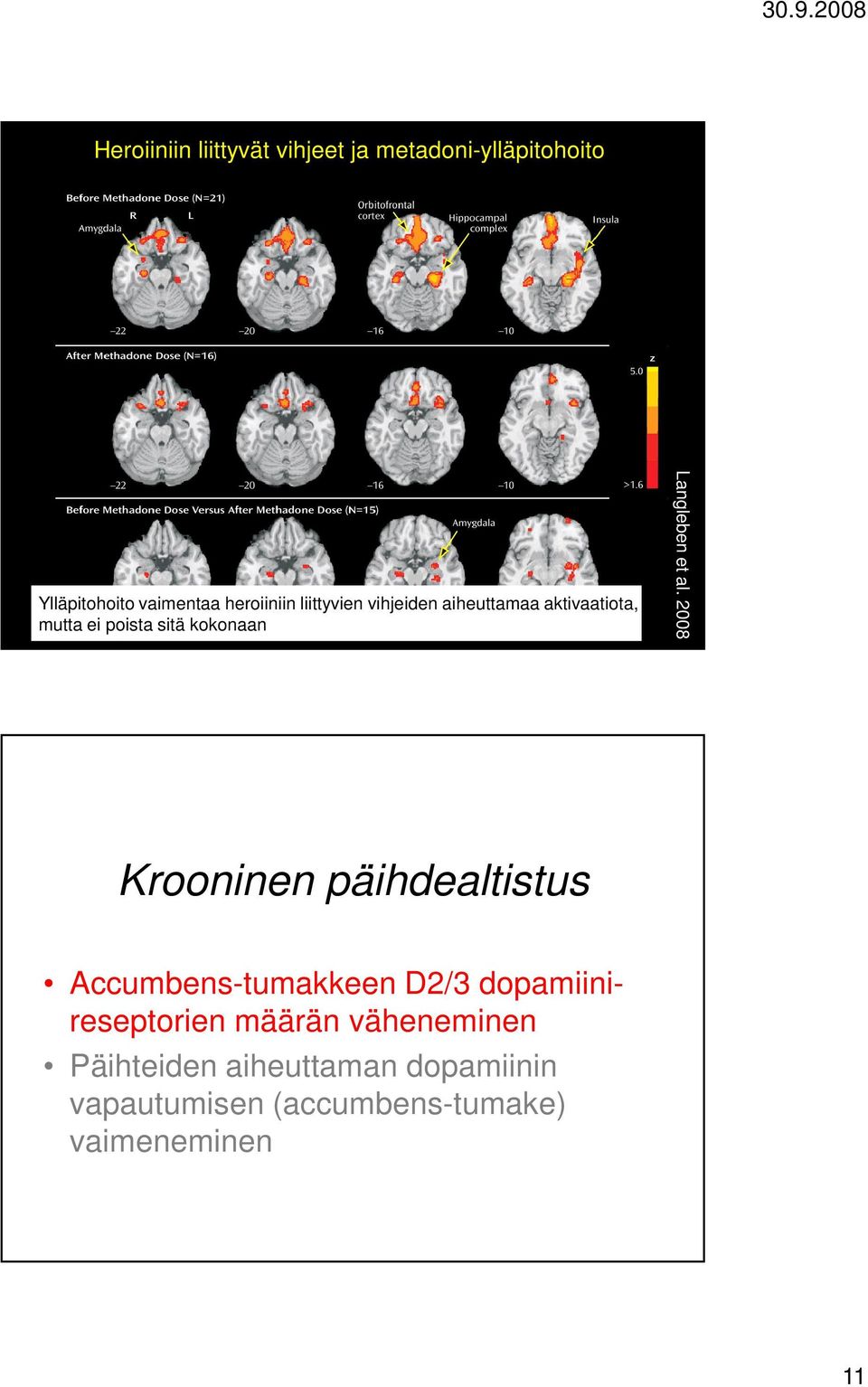 al. 2008 Krooninen päihdealtistus Accumbens-tumakkeen D2/3 dopamiinireseptorien määrän