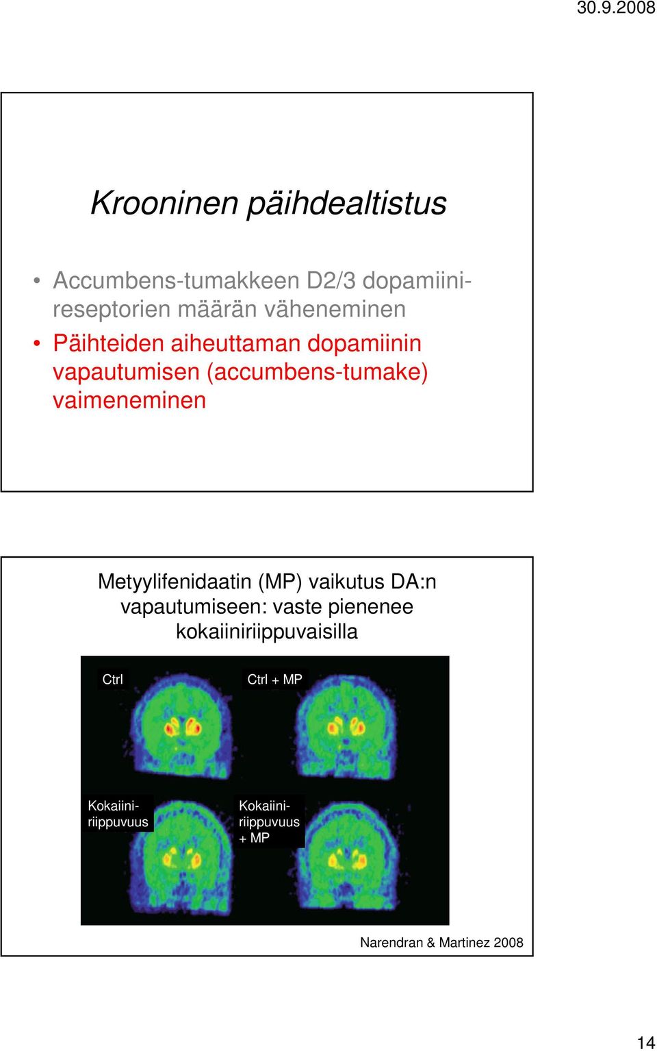 vaimeneminen Metyylifenidaatin (MP) vaikutus DA:n vapautumiseen: vaste pienenee