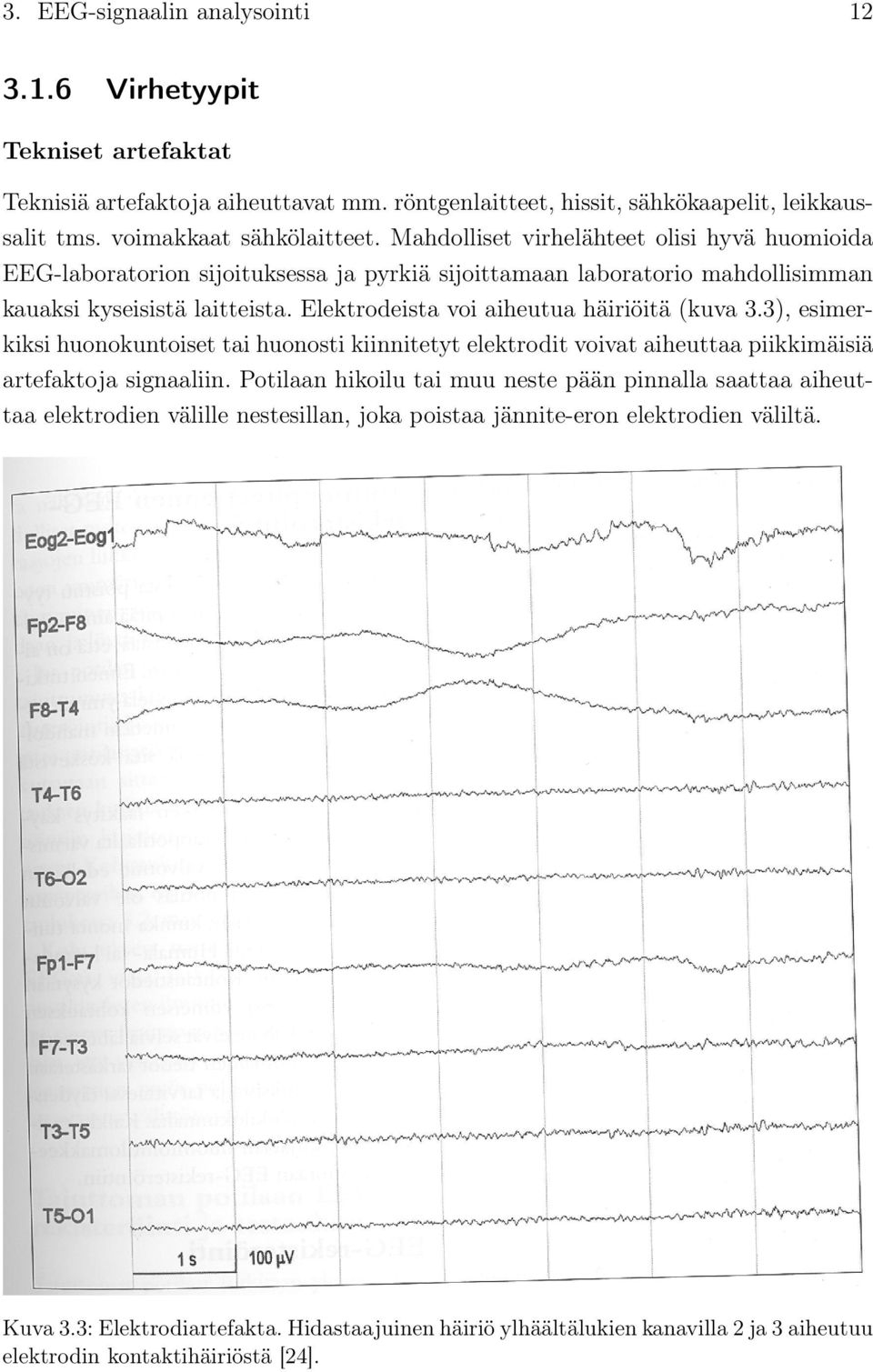 Elektrodeista voi aiheutua häiriöitä (kuva 3.3), esimerkiksi huonokuntoiset tai huonosti kiinnitetyt elektrodit voivat aiheuttaa piikkimäisiä artefaktoja signaaliin.