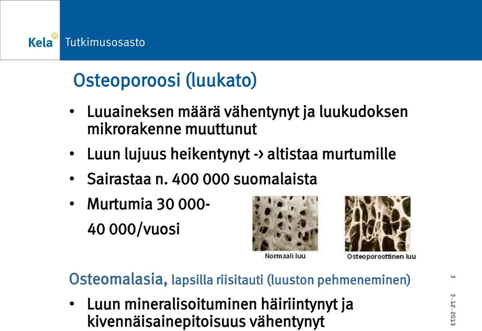 400 000 suomalaista Murtumia 30 000-40 000/vuosi Osteomalasia, lapsilla riisitauti