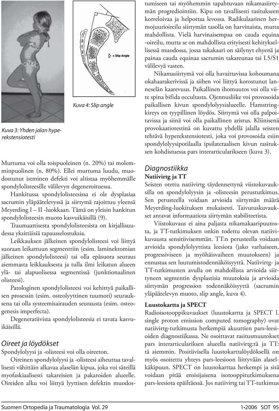 Hankitussa spondylolisteesissa ei ole dysplasiaa sacrumin yläpäätelevyssä ja siirtymä rajoittuu yleensä Meyerding I II -luokkaan. Tämä on yleisin hankitun spondylolisteesin muoto kasvuikäisillä (9).