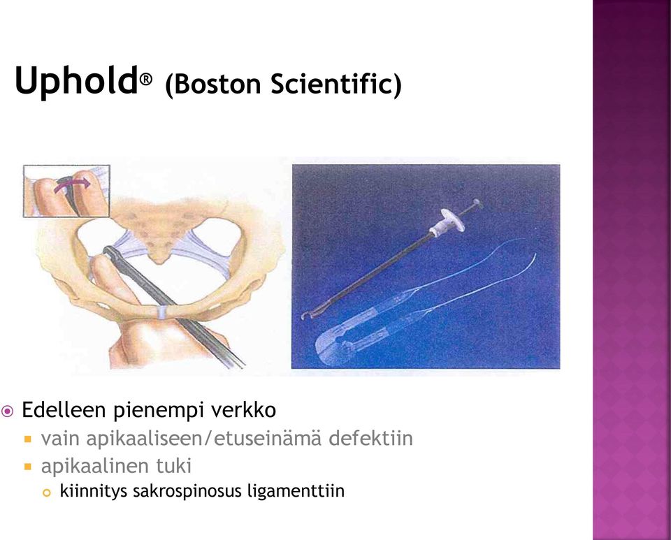 apikaaliseen/etuseinämä defektiin