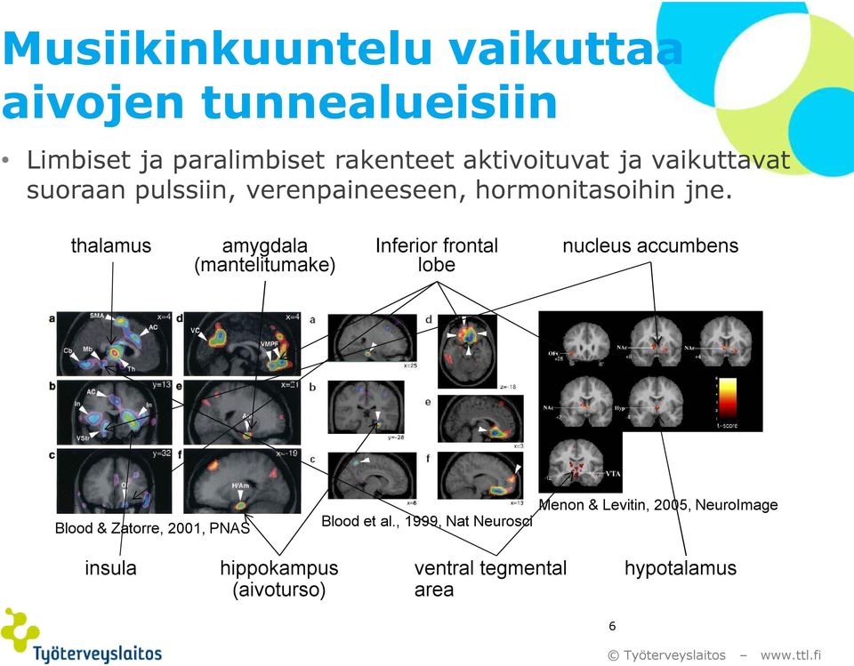 thalamus amygdala (mantelitumake) Inferior frontal lobe nucleus accumbens Blood & Zatorre, 2001, PNAS