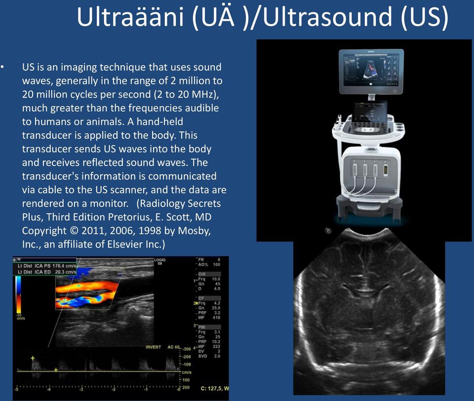 This transducer sends US waves into the body and receives reflected sound waves.