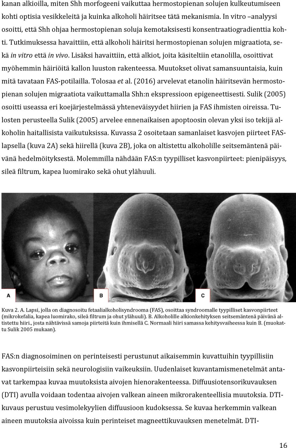 Tutkimuksessa havaittiin, että alkoholi häiritsi hermostopienan solujen migraatiota, sekä in vitro että in vivo.