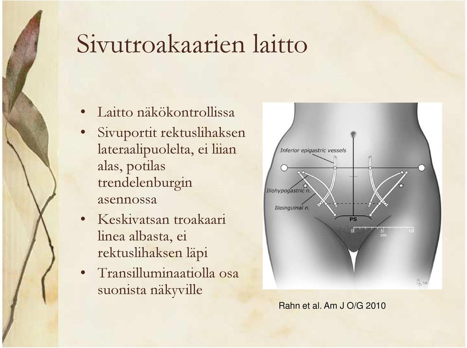 trendelenburgin asennossa Keskivatsan troakaari linea albasta, ei