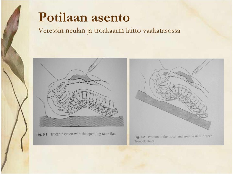 ja troakaarin