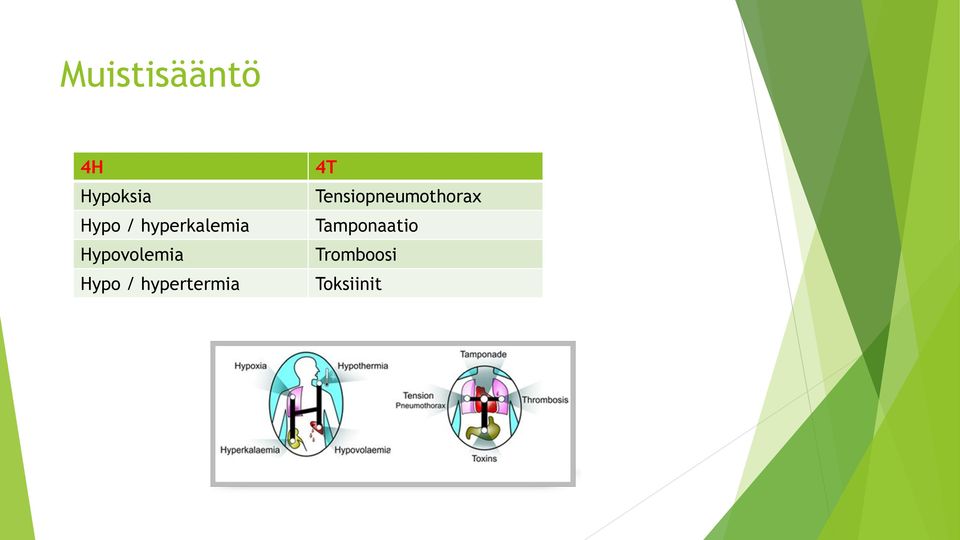 hypertermia 4T