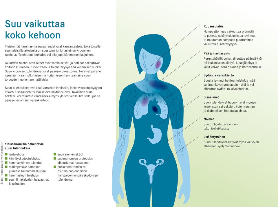 Suun krooniset tulehdukset ovat pääosin oireettomia. Ne eivät parane itsestään, vaan tutkimiseen ja hoitamiseen tarvitaan aina suun terveydenhuollon ammattilaisia.