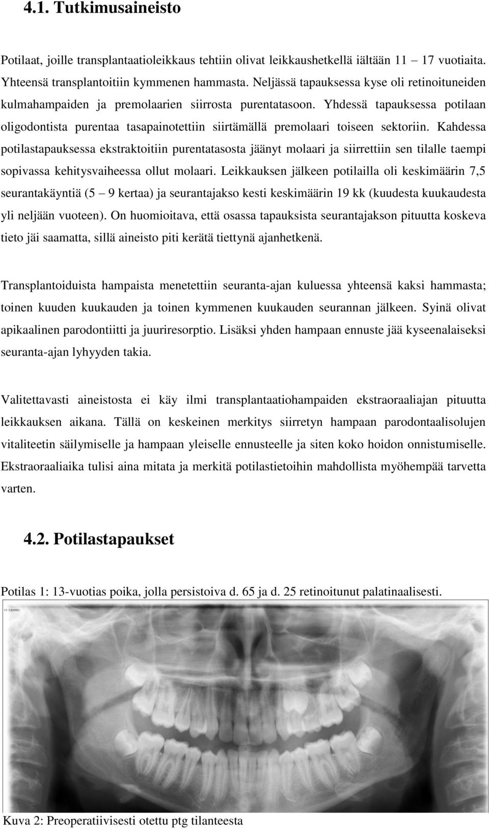 Yhdessä tapauksessa potilaan oligodontista purentaa tasapainotettiin siirtämällä premolaari toiseen sektoriin.