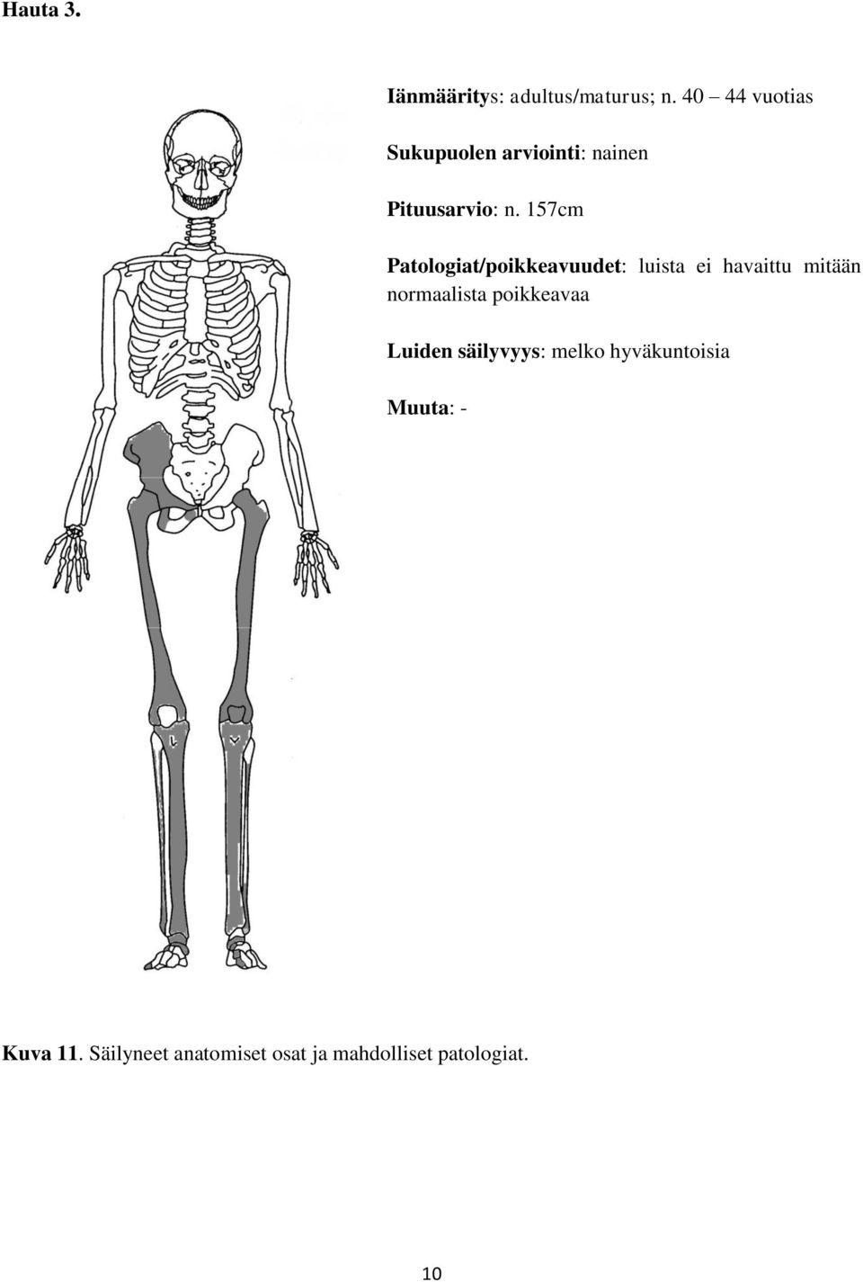157cm Patologiat/poikkeavuudet: luista ei havaittu mitään normaalista