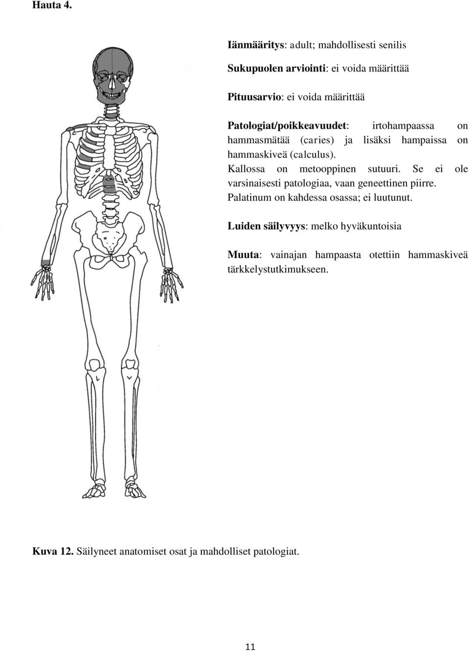 Patologiat/poikkeavuudet: irtohampaassa on hammasmätää (caries) ja lisäksi hampaissa on hammaskiveä (calculus).