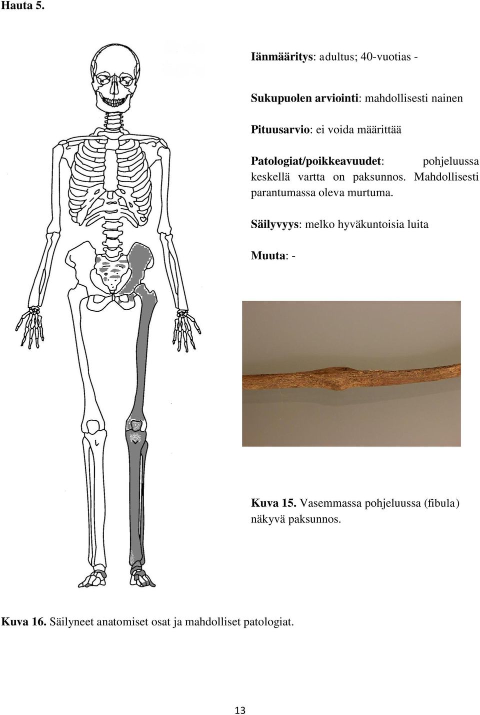 määrittää Patologiat/poikkeavuudet: pohjeluussa keskellä vartta on paksunnos.