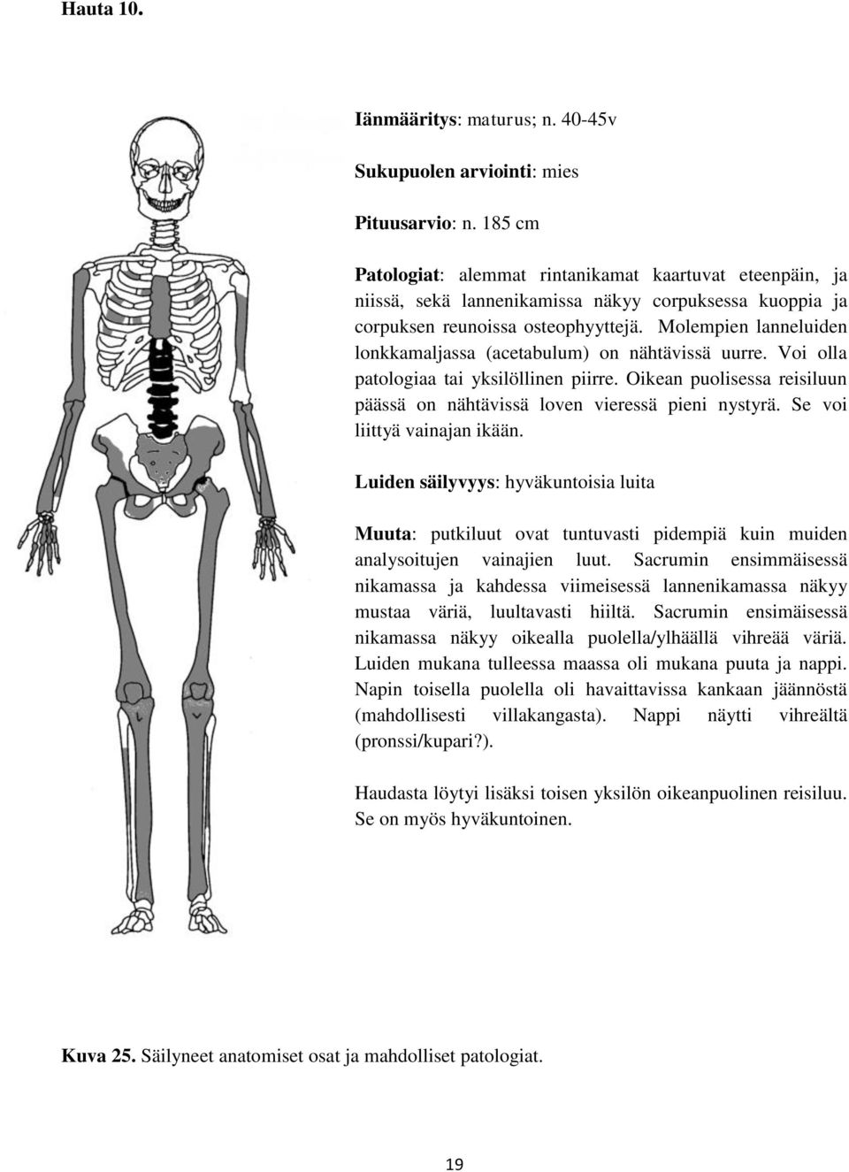 Molempien lanneluiden lonkkamaljassa (acetabulum) on nähtävissä uurre. Voi olla patologiaa tai yksilöllinen piirre. Oikean puolisessa reisiluun päässä on nähtävissä loven vieressä pieni nystyrä.