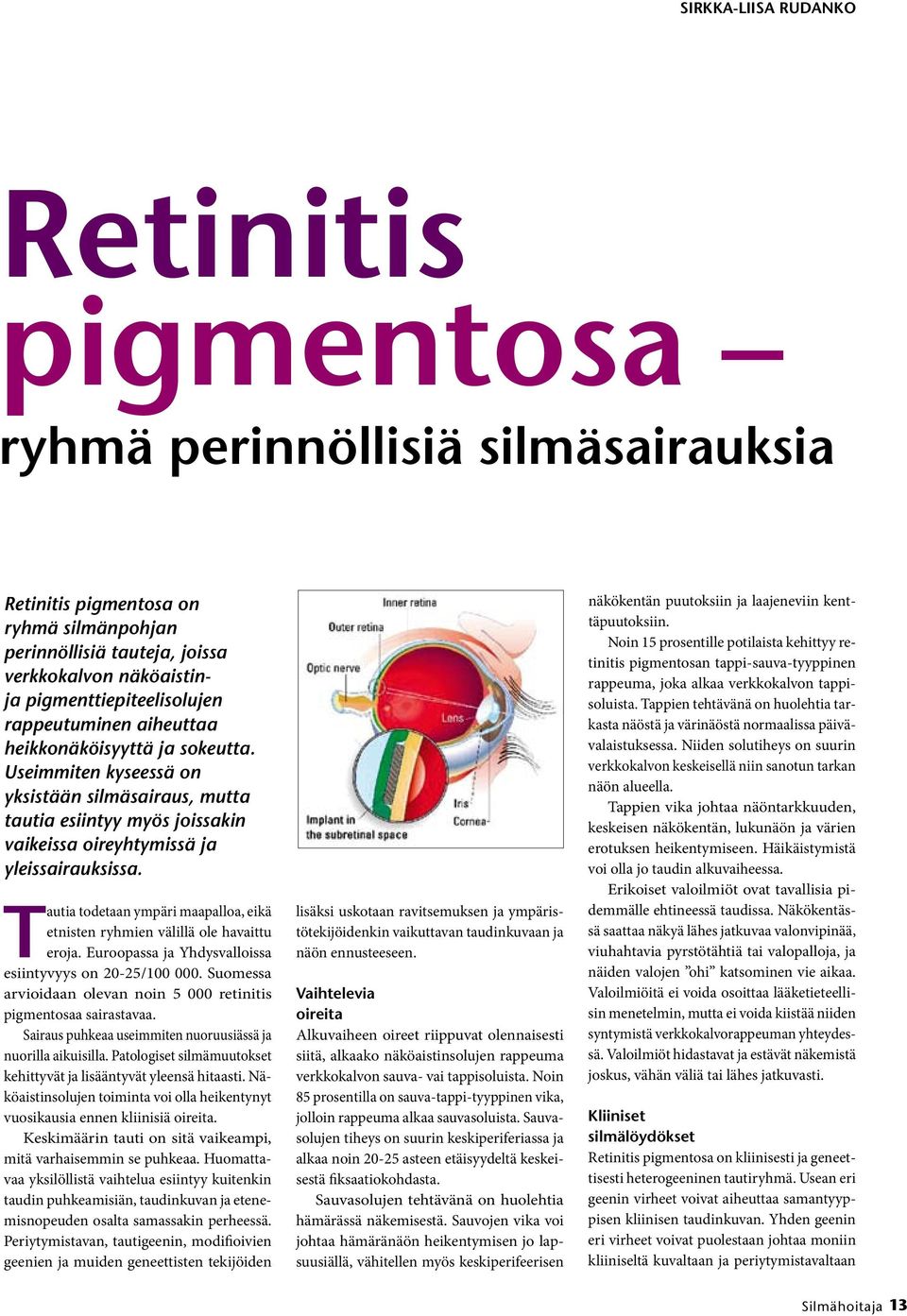 Useimmiten kyseessä on yksistään silmäsairaus, mutta tautia esiintyy myös joissakin vaikeissa oireyhtymissä ja yleissairauksissa.