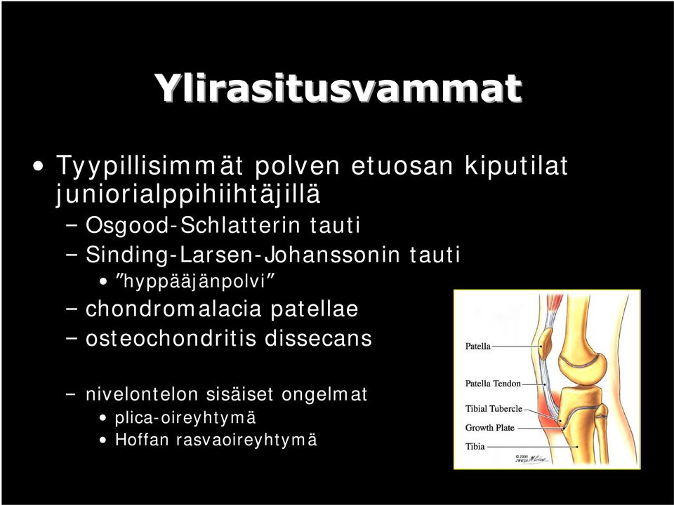 hyppääjänpolvi chondromalacia patellae osteochondritis dissecans