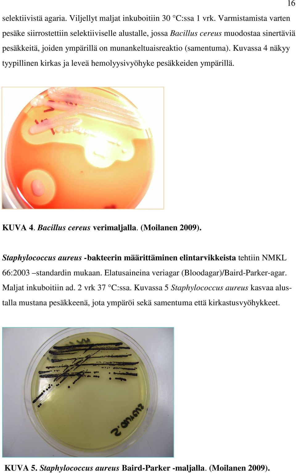 Kuvassa 4 näkyy tyypillinen kirkas ja leveä hemolyysivyöhyke pesäkkeiden ympärillä. KUVA 4. Bacillus cereus verimaljalla. (Moilanen 2009).