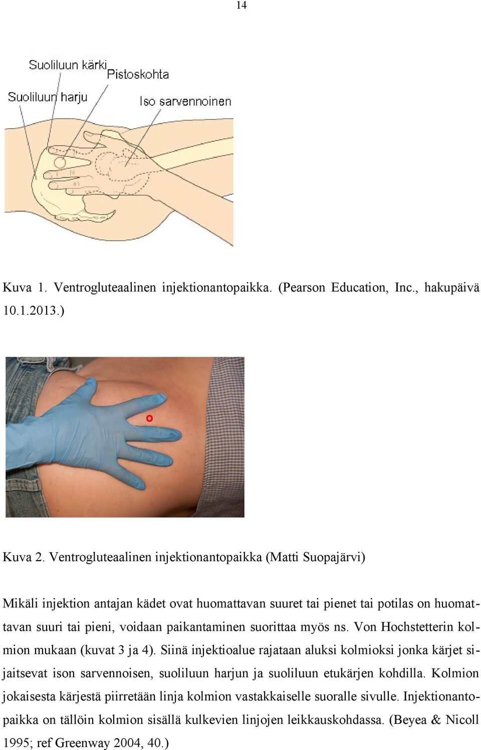paikantaminen suorittaa myös ns. Von Hochstetterin kolmion mukaan (kuvat 3 ja 4).