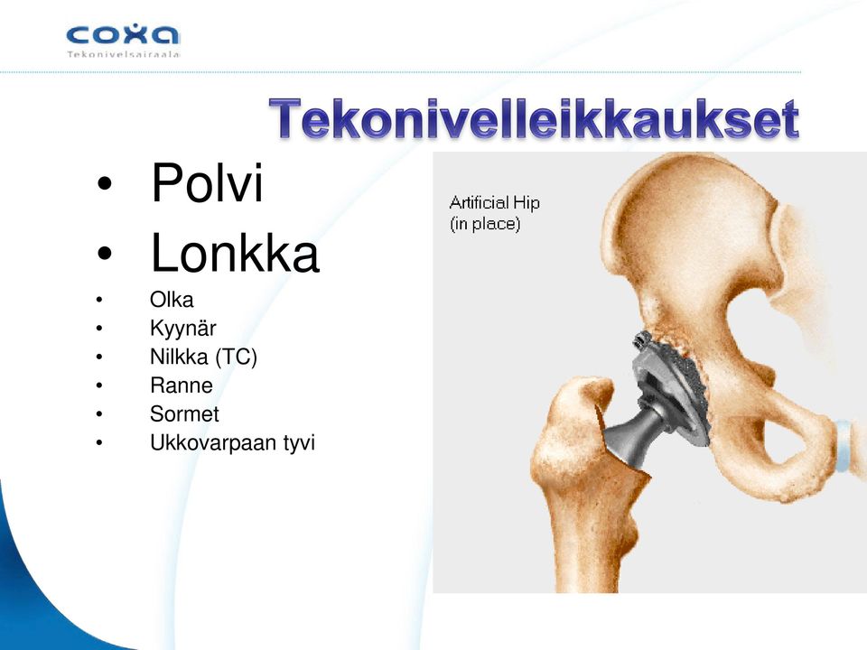 Nilkka (TC)