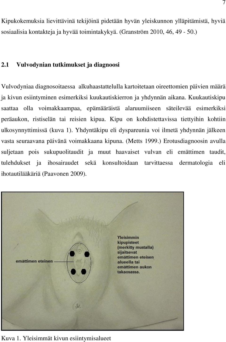 Kuukautiskipu saattaa olla voimakkaampaa, epämääräistä alaruumiiseen säteilevää esimerkiksi peräaukon, ristiselän tai reisien kipua.