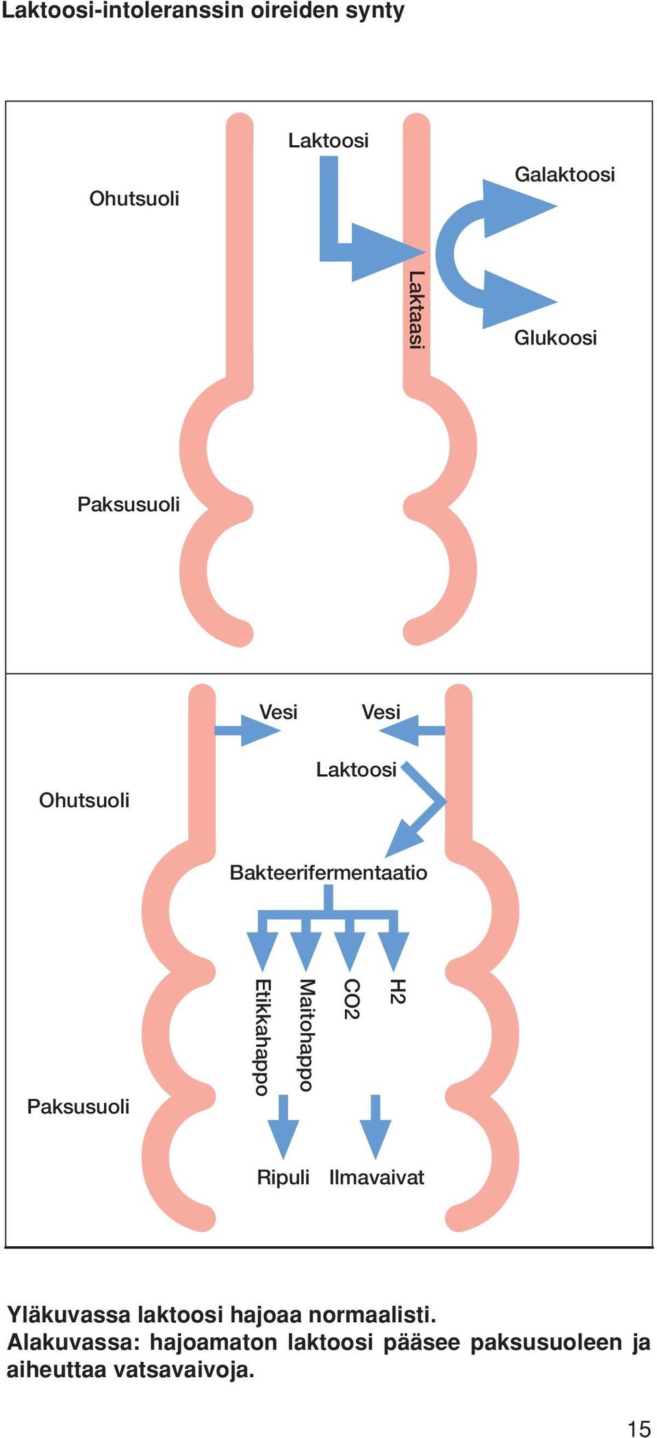Etikkahappo Maitohappo CO2 H2 Ripuli Ilmavaivat Yläkuvassa laktoosi hajoaa