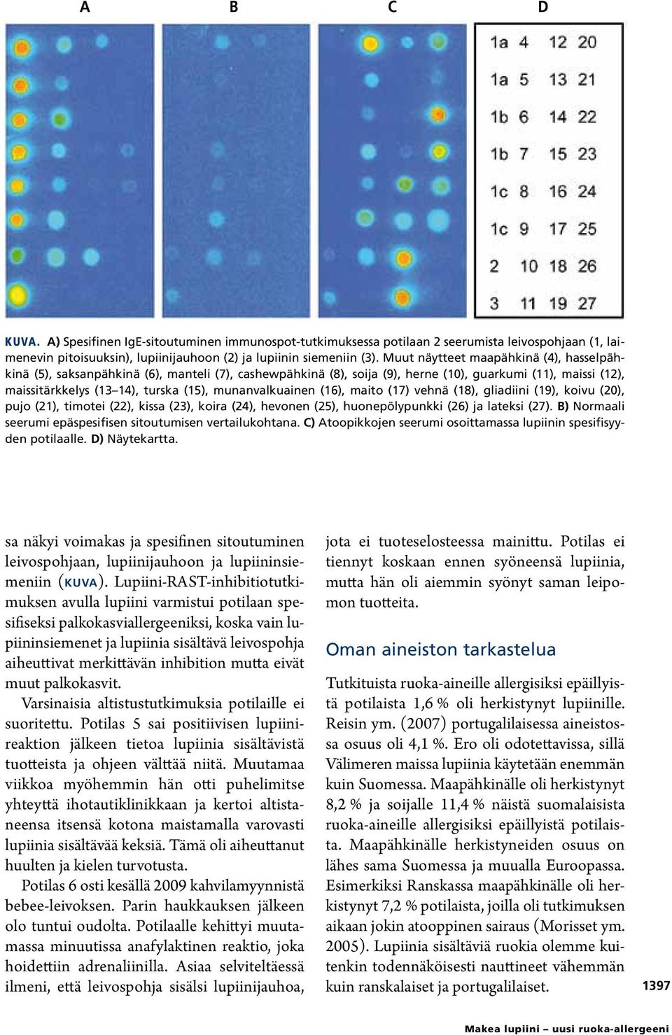 munanvalkuainen (16), maito (17) vehnä (18), gliadiini (19), koivu (20), pujo (21), timotei (22), kissa (23), koira (24), hevonen (25), huonepölypunkki (26) ja lateksi (27).