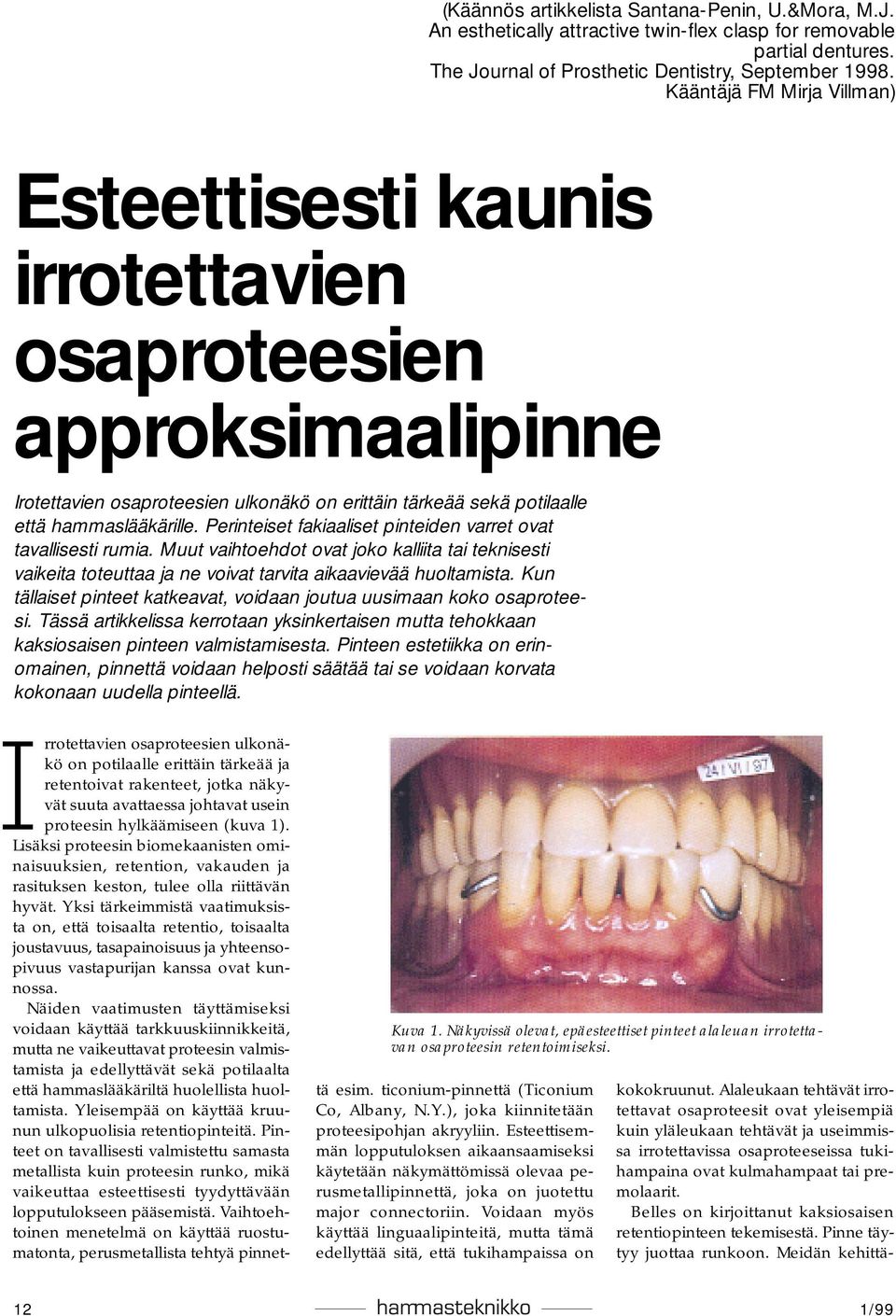 Perinteiset fakiaaliset pinteiden varret ovat tavallisesti rumia. Muut vaihtoehdot ovat joko kalliita tai teknisesti vaikeita toteuttaa ja ne voivat tarvita aikaavievää huoltamista.