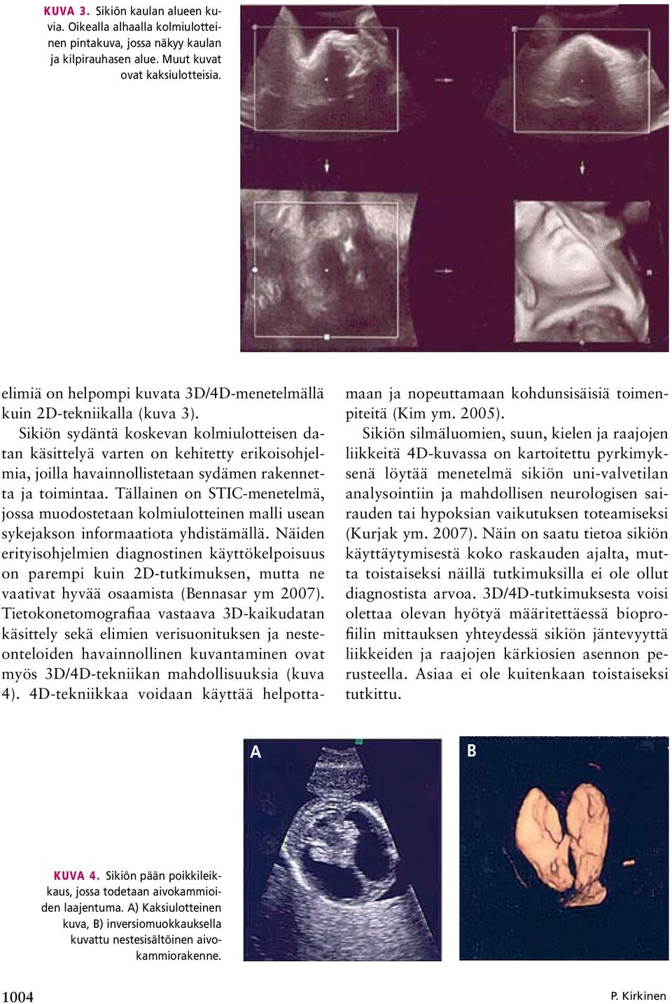 Sikiön sydäntä koskevan kolmiulotteisen datan käsittelyä varten on kehitetty erikoisohjelmia, joilla havainnollistetaan sydämen rakennetta ja toimintaa.