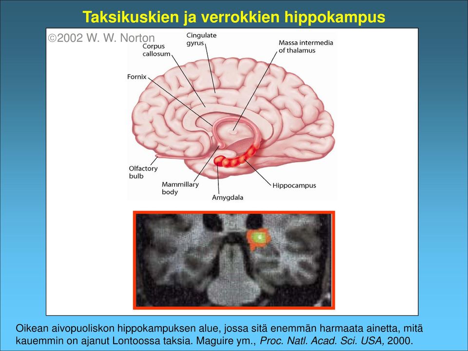 jossa sitä enemmän harmaata ainetta, mitä kauemmin on