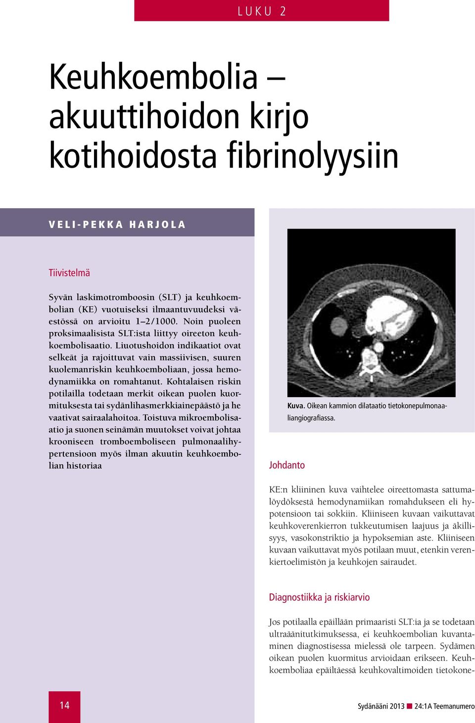 Liuotushoidon indikaatiot ovat selkeät ja rajoittuvat vain massiivisen, suuren kuolemanriskin keuhkoemboliaan, jossa hemodynamiikka on romahtanut.