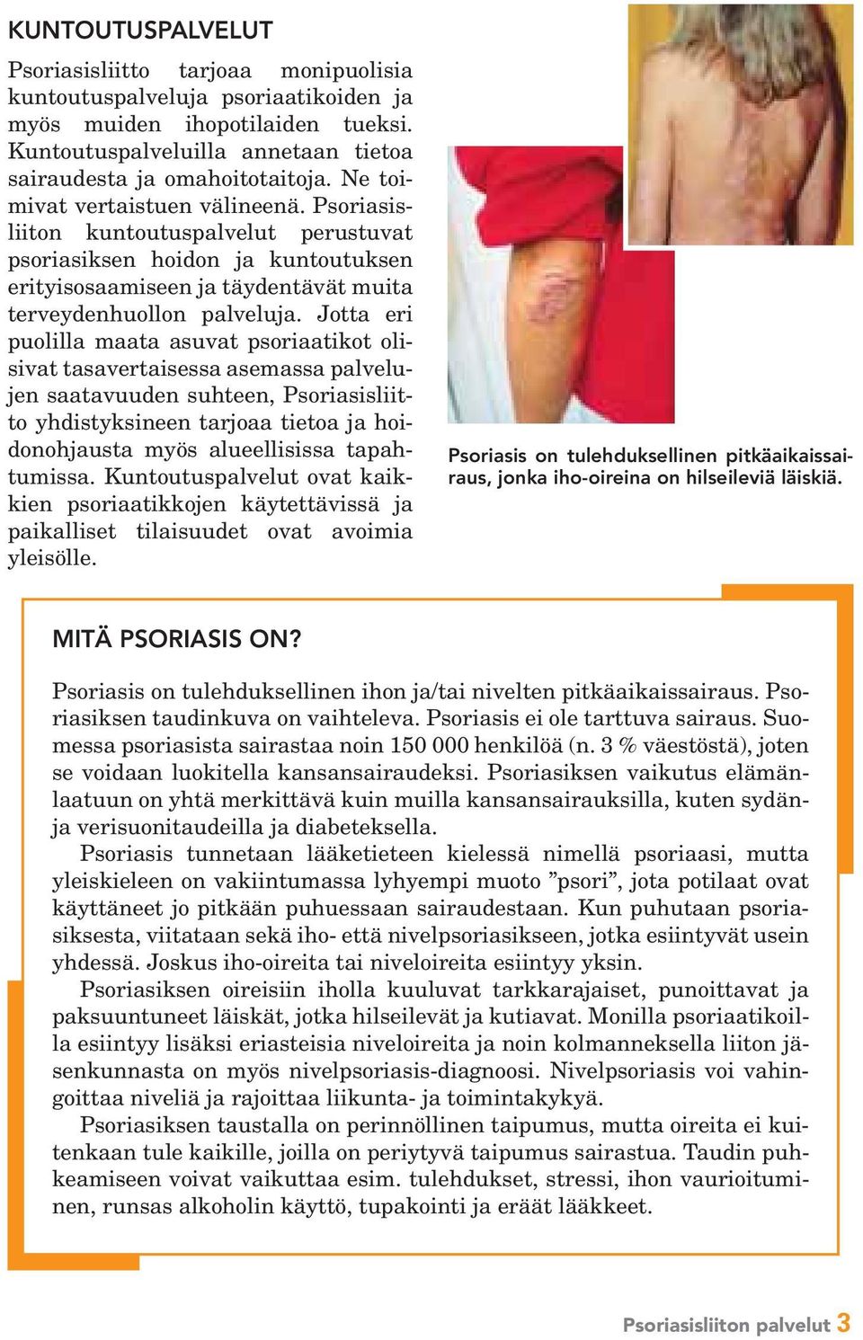 Jotta eri puolilla maata asuvat psoriaatikot olisivat tasavertaisessa asemassa palvelujen saatavuuden suhteen, Psoriasisliitto yhdistyksineen tarjoaa tietoa ja hoidonohjausta myös alueellisissa