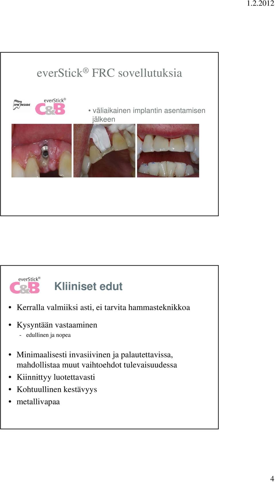 edullinen ja nopea Minimaalisesti invasiivinen ja palautettavissa, mahdollistaa muut