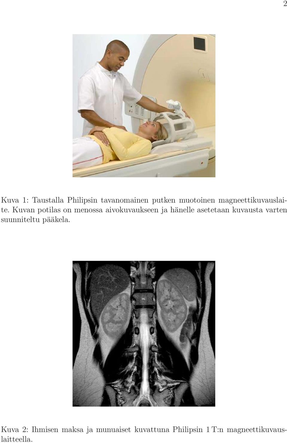 Kuvan potilas on menossa aivokuvaukseen ja hänelle asetetaan