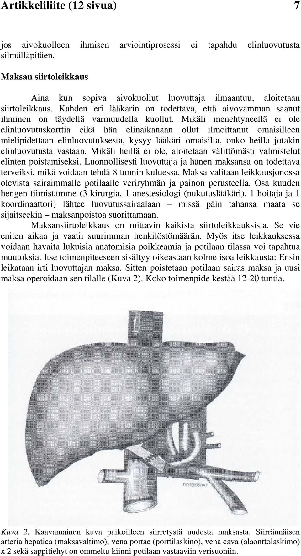 Mikäli menehtyneellä ei ole elinluovutuskorttia eikä hän elinaikanaan ollut ilmoittanut omaisilleen mielipidettään elinluovutuksesta, kysyy lääkäri omaisilta, onko heillä jotakin elinluovutusta