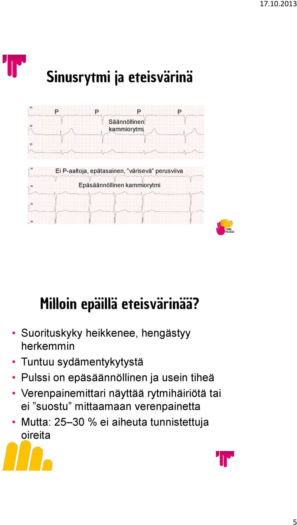 Suorituskyky heikkenee, hengästyy herkemmin Tuntuu sydämentykytystä Pulssi on epäsäännöllinen ja