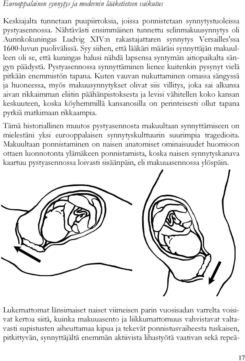 Syy siihen, että lääkäri määräsi synnyttäjän makuulleen oli se, että kuningas halusi nähdä lapsensa syntymän aitiopaikalta sängyn päädystä.