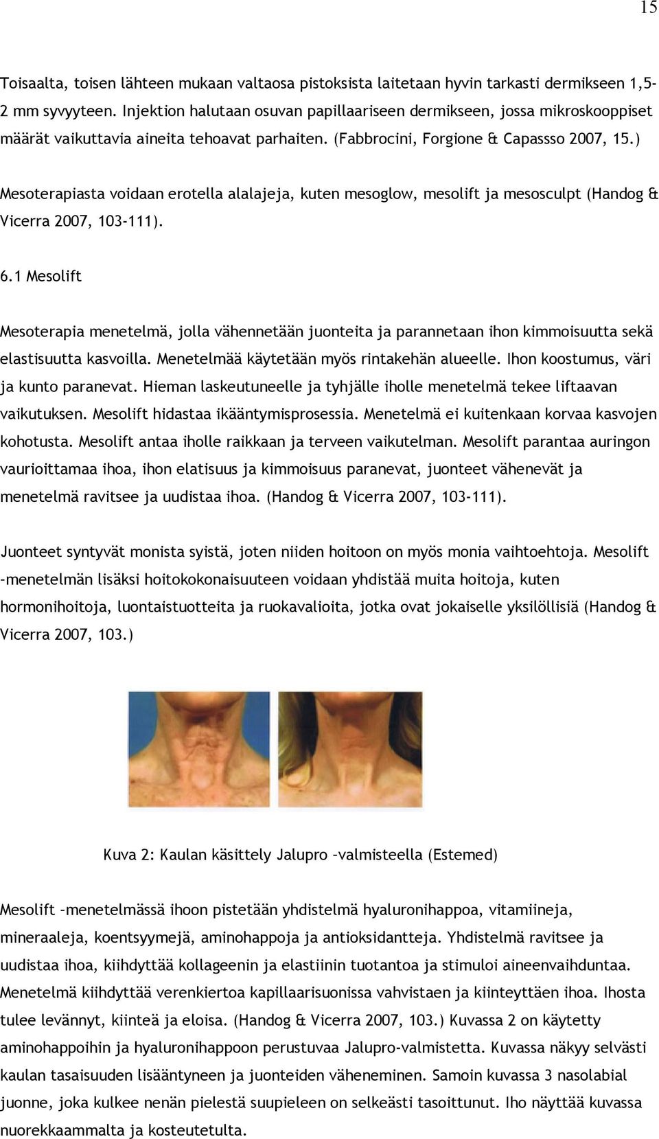 ) Mesoterapiasta voidaan erotella alalajeja, kuten mesoglow, mesolift ja mesosculpt (Handog & Vicerra 2007, 103-111). 6.