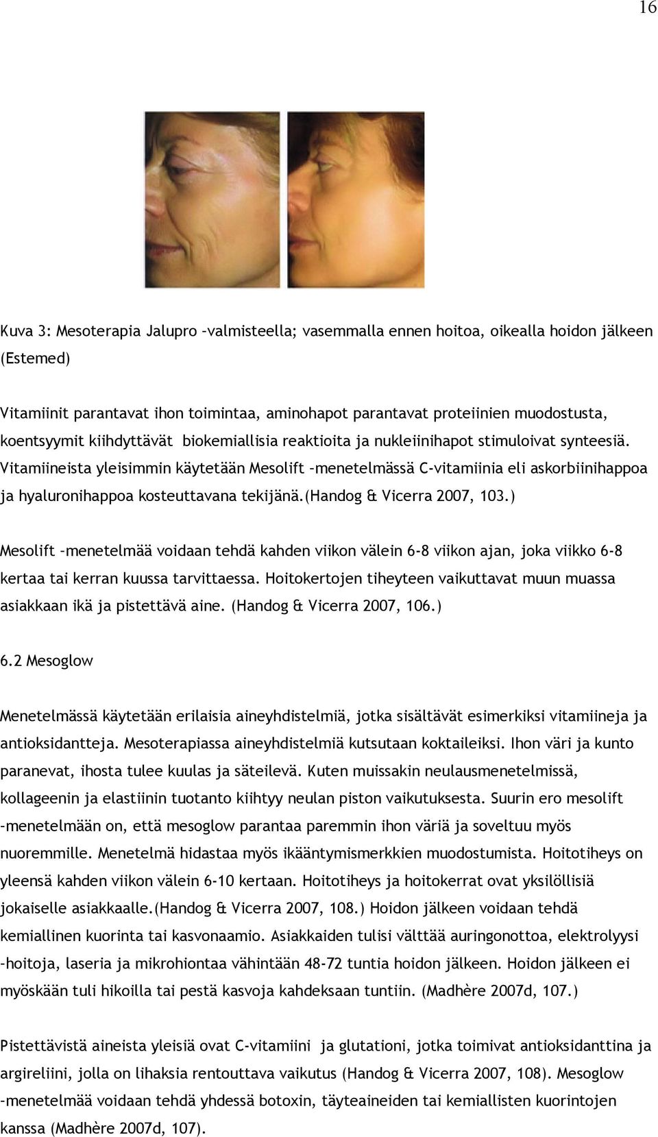 Vitamiineista yleisimmin käytetään Mesolift menetelmässä C-vitamiinia eli askorbiinihappoa ja hyaluronihappoa kosteuttavana tekijänä.(handog & Vicerra 2007, 103.