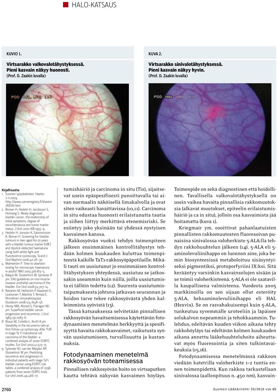 Newly diagnosed bladder cancer: the relationship of initial symptoms, degree of microhematuria and tumor marker status. J Urol 2002;168:1955 9. 3 Hedelin H, Jonsson K, Salomonsson K, Boman H.