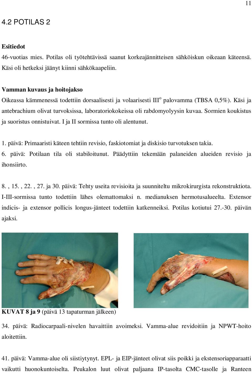 Käsi ja antebrachium olivat turvoksissa, laboratoriokokeissa oli rabdomyolyysin kuvaa. Sormien koukistus ja suoristus onnistuivat. I ja II sormissa tunto oli alentunut. 1.