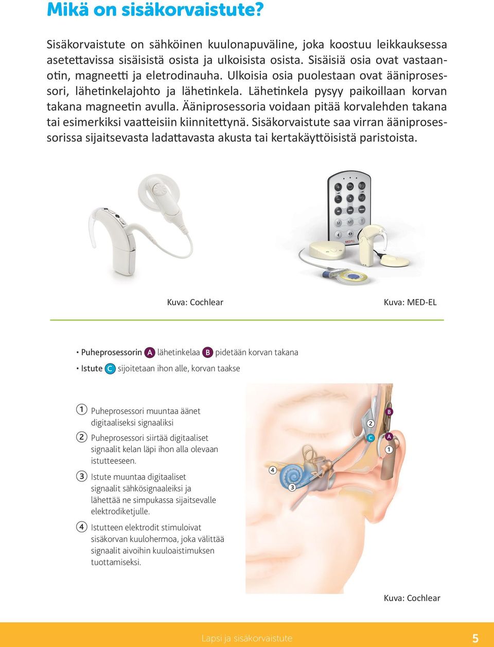 Ääniprosessoria voidaan pitää korvalehden takana tai esimerkiksi vaatteisiin kiinnitettynä.