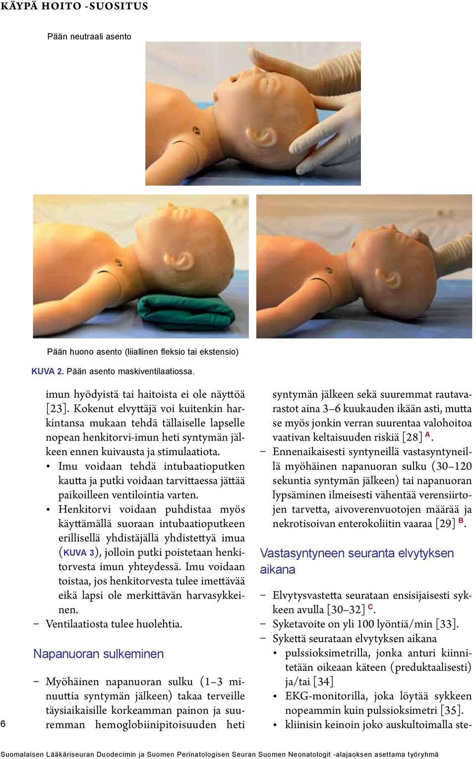 Imu voidaan tehdä intubaatioputken kautta ja putki voidaan tarvittaessa jättää paikoilleen ventilointia varten.