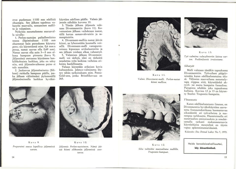 Nastat saavat olla noin 3 5 mm ulkona hampaan pinnasta (kuva 9). Jäljennöstä otettaessa käytämme henkilökohtaista lusikkaa, joka on tehty niin, että jäijennösvaiheessa paino ei tule nastoihin. 2.