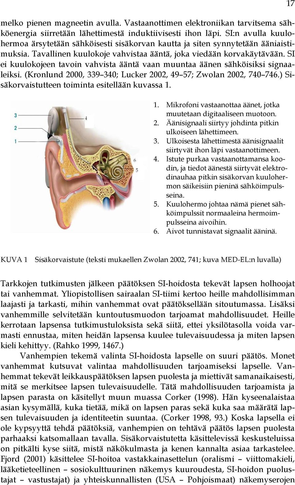 SI ei kuulokojeen tavoin vahvista ääntä vaan muuntaa äänen sähköisiksi signaaleiksi. (Kronlund 2000, 339 340; Lucker 2002, 49 57; Zwolan 2002, 740 746.