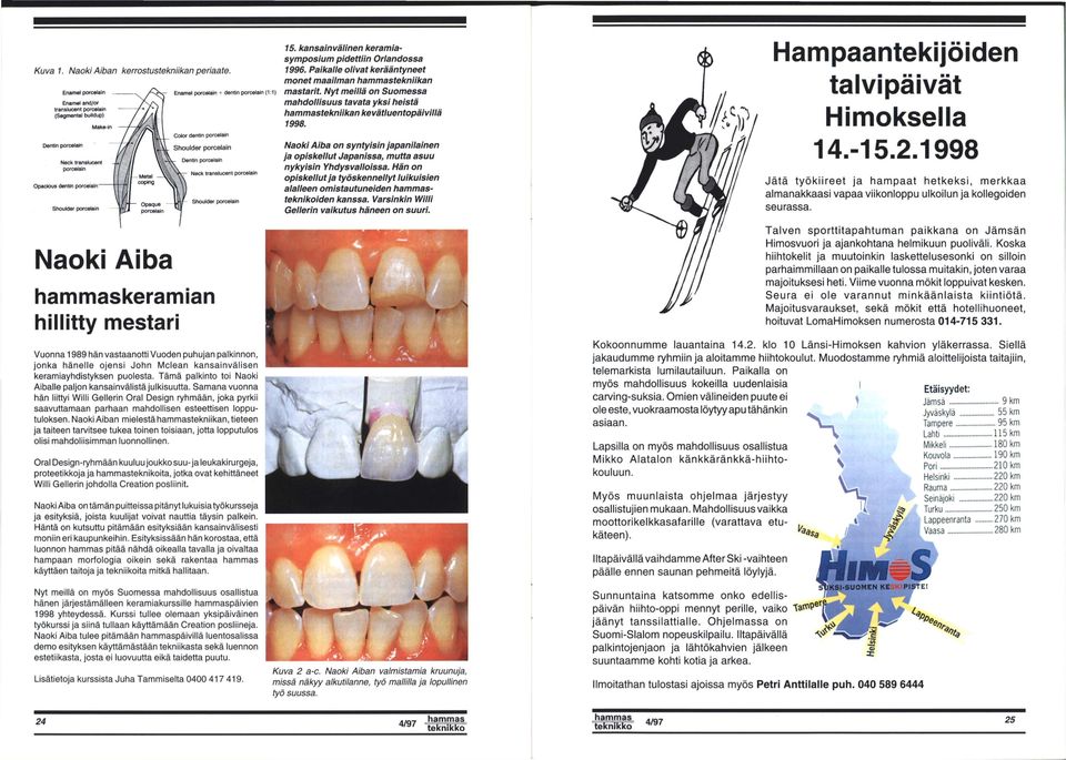 porceiain (1:1) Cotor dentin porceiain Shoulder porceiain Dentin porceiain Neck translucent porceiain Shoulder porceiain 15. kansainvälinen keramiasymposium pidettiin Orlandossa 1996.