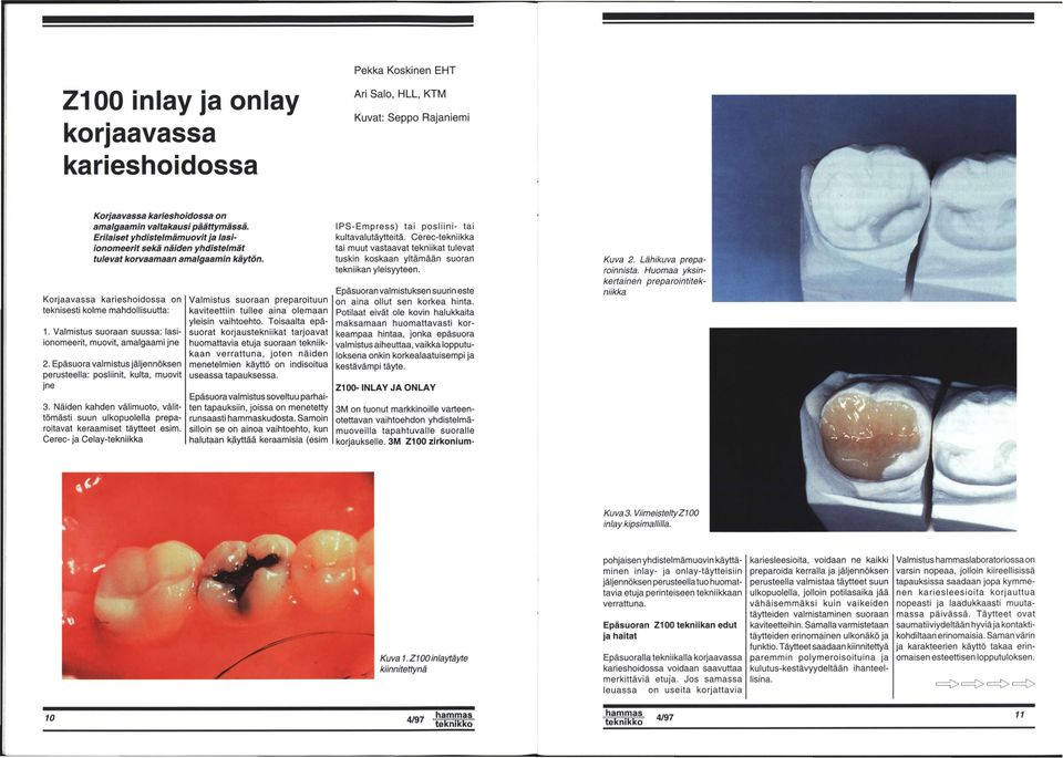 Valmistus suoraan suussa: lasiionomeerit, muovit, amalgaami jne 2. Epäsuora valmistus jäljennöksen perusteella: posliinit, kulta, muovit jne 3.