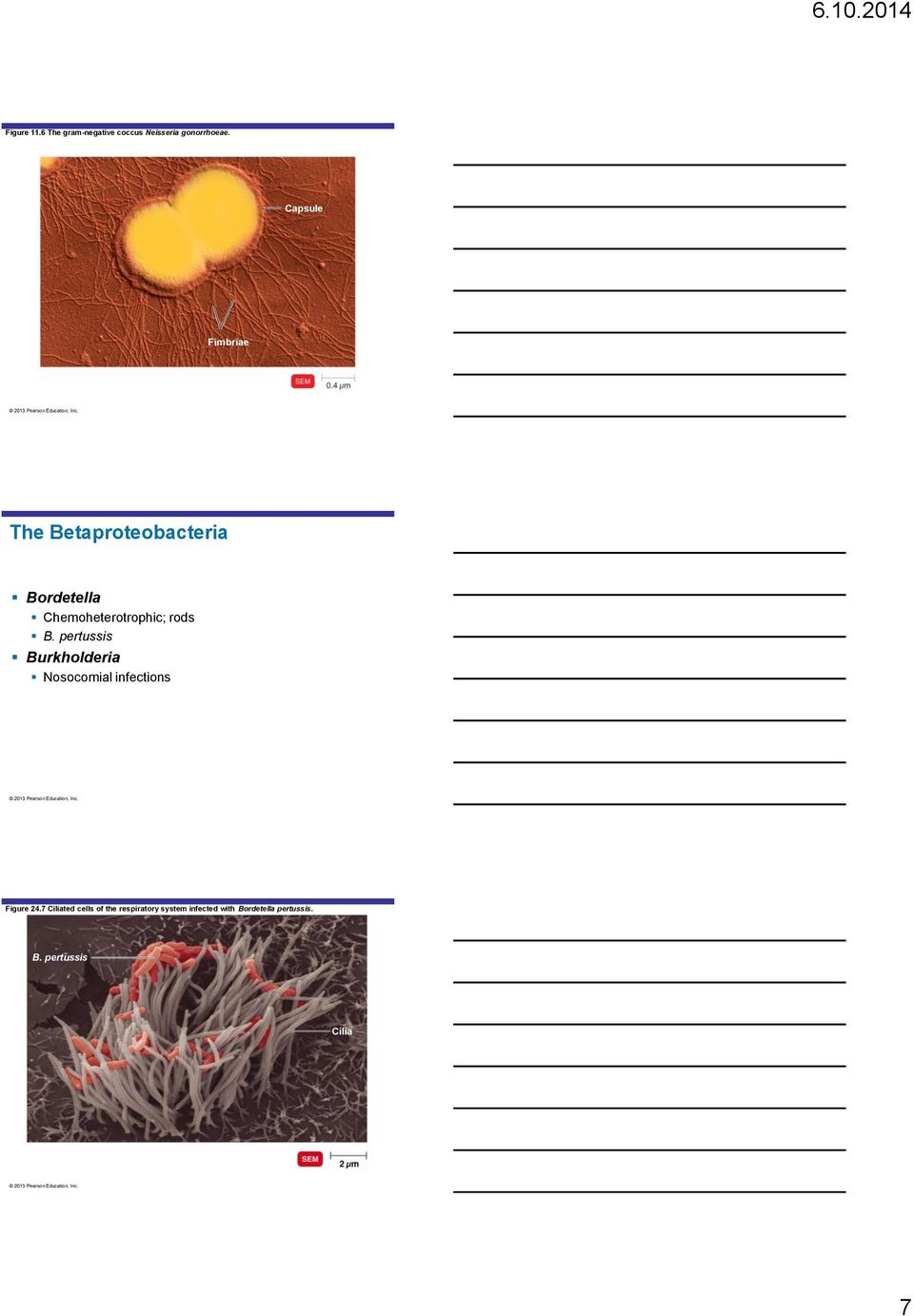 rods B. pertussis Burkholderia Nosocomial infections Figure 24.