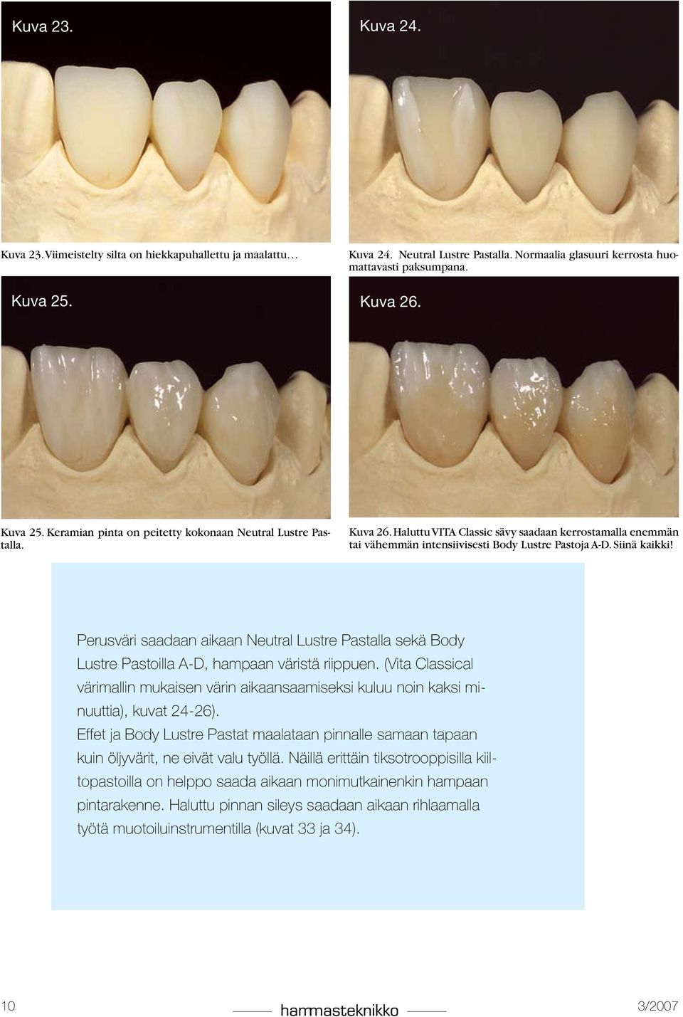 Siinä kaikki! Perusväri saadaan aikaan Neutral Lustre Pastalla sekä Body Lustre Pastoilla A-D, hampaan väristä riippuen.